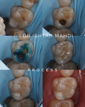Process